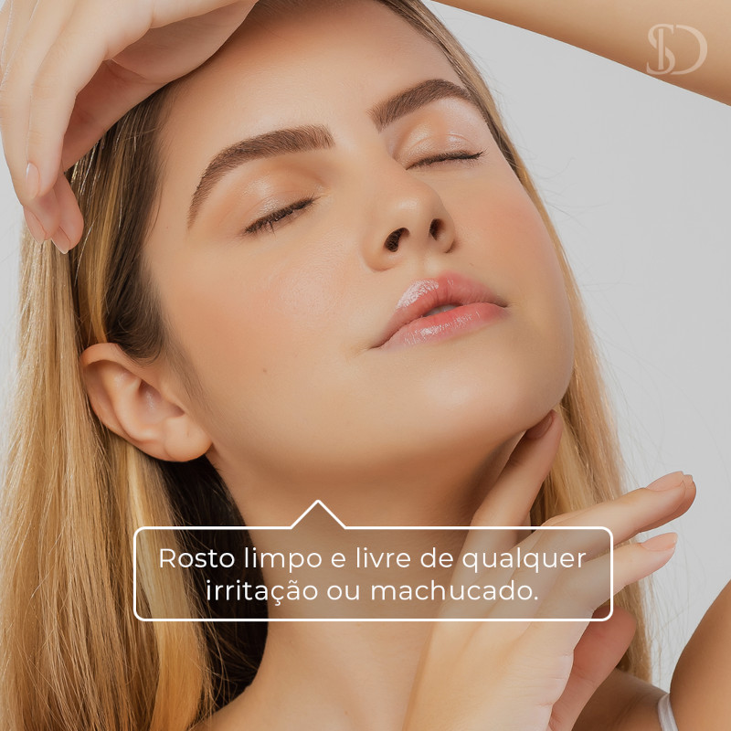 Epilação facial com linhas sd Vila Madalena